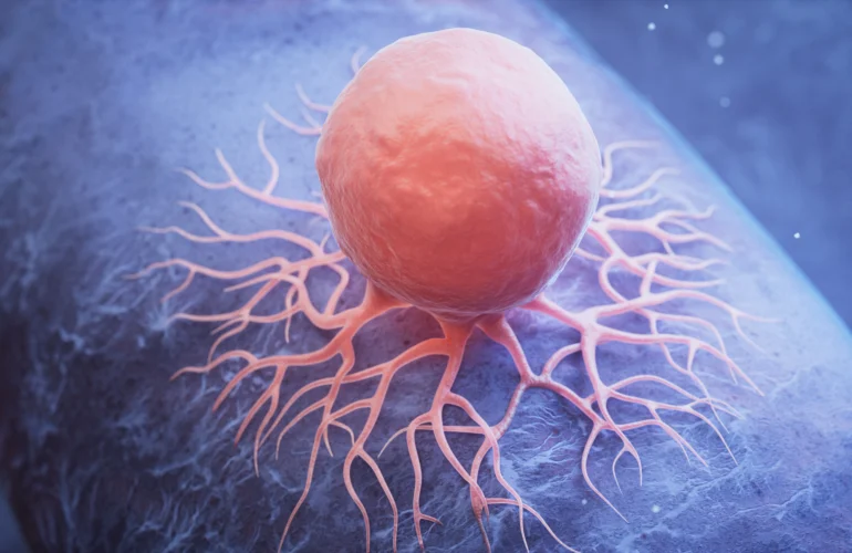 Is Cancer Genetic