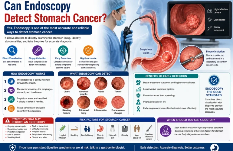 Can Endoscopy Detect Stomach Cancer